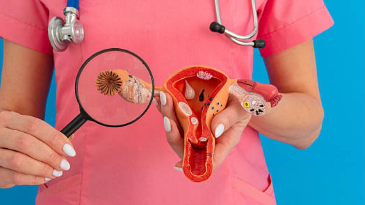 ओटीपोटात वाढलेल्या वेदनांकडे अजिबात करू नका दुर्लक्ष? ओव्हेरियन सिस्ट फुटण्याच्या आधी शरीरात दिसून येतात ‘ही’ गंभीर लक्षणे