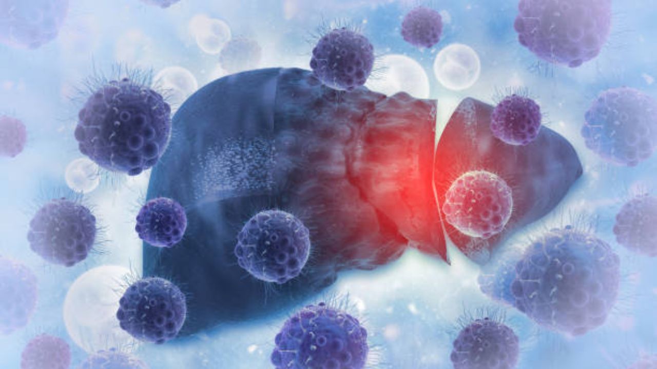 Liver Day 2026: वेळीच करा उपाय, टाळा Liver Cancer, तज्ज्ञांनी दिला योग्य सल्ला