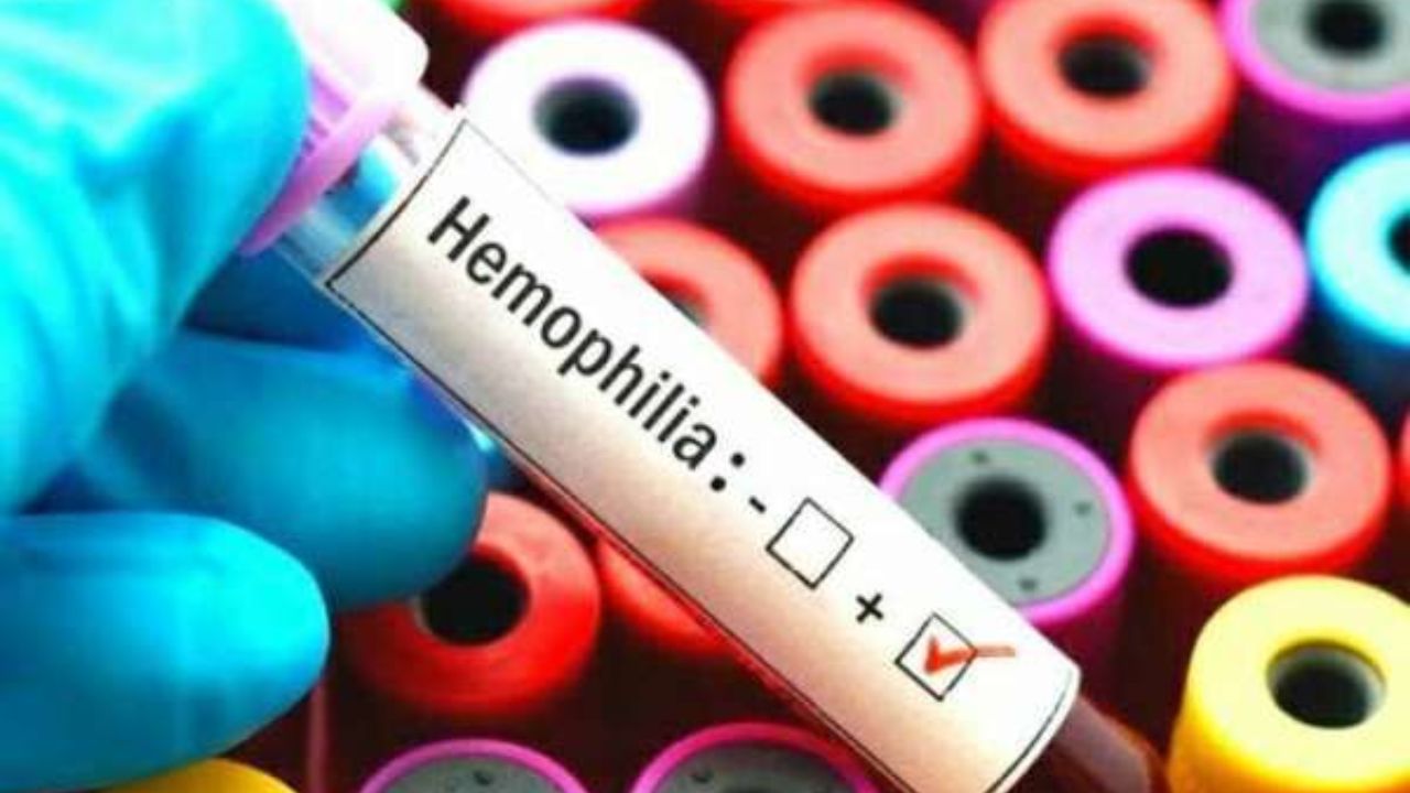 Red For WHD : काय आहे ‘रॉयल डिसीज’? 17 एप्रिल ‘जागतिक हिमोफिलिया दिन’; जाणून घ्या लक्षणे आणि उपचार एका क्लिकवर