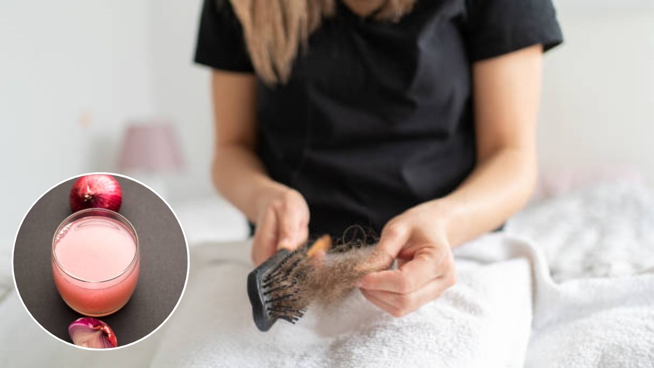 केसगळती थांबवायची तर कांद्याच्या रसात मिसळा ‘हे’ दोन घटक, मास्टरशेफ पंकज भदोरियाने सांगितला प्रभावी घरगुती उपाय