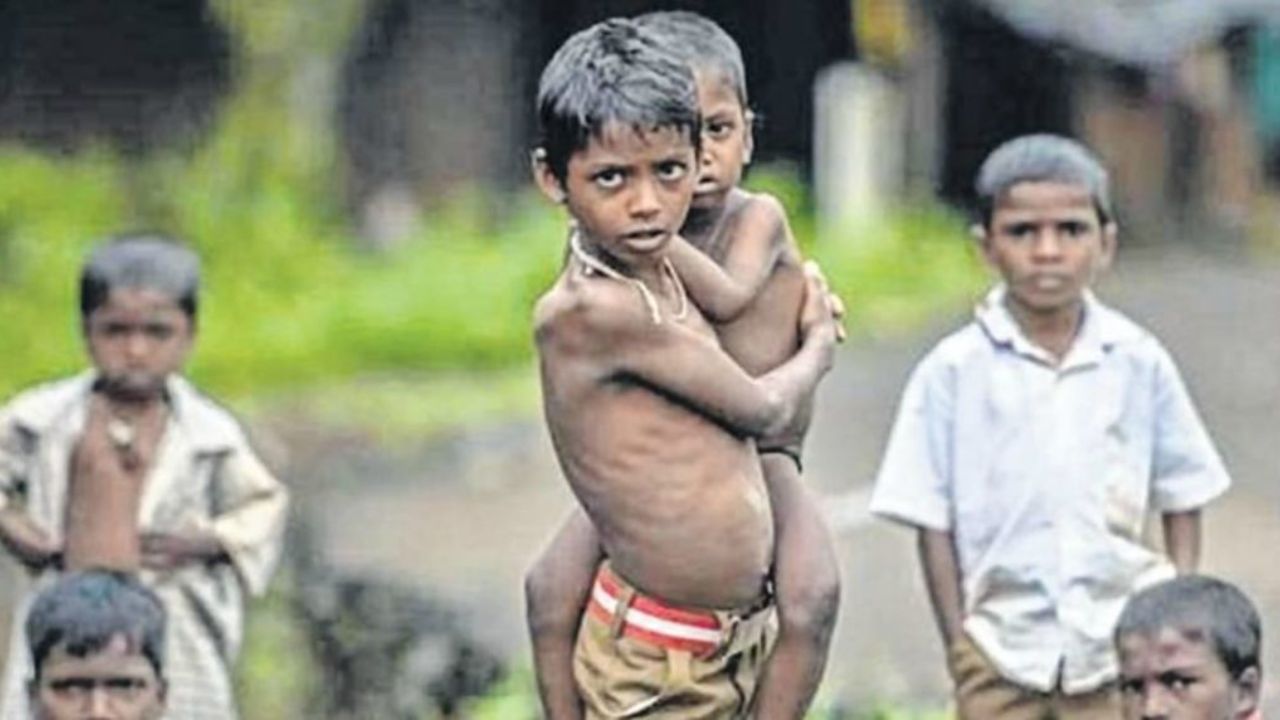 Malnutrition in Raigad 2026: रायगडमध्ये कुपोषणाचा विळखा: ४१ बालके मृत्यूच्या उंबरठ्यावर?