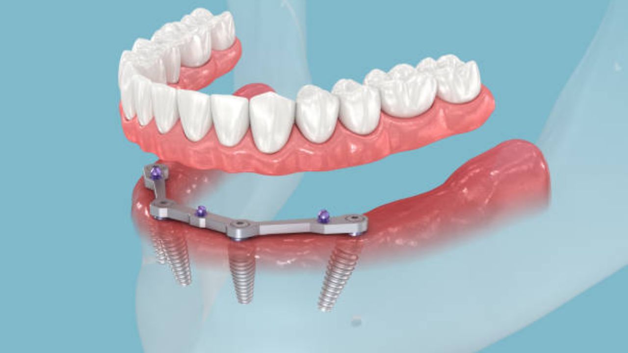 Teeth Care: कृत्रिम दातांची काळजी कशा पद्धतीने घ्यावी? जाणून घ्या स्वच्छता, वापर आणि काळजी घेण्याच्या महत्वपूर्ण टिप्स