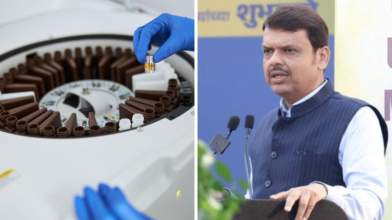 Mumbai News: नायरमध्ये बायोकेमिस्ट्री ब्लड ॲनालायझर! सीएसआर निधीतून सहाय्य; अत्याधुनिक व दर्जेदार सेवा मिळणार