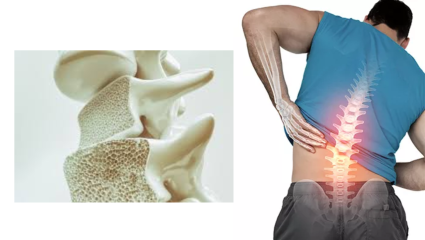 केवळ महिलांनाच नाही, तर तरुण पुरुषांनाही होतोय ‘हा’ सायलेंट आजार; किरकोळ दुखापतीने फ्रॅक्चर होत असल्यास व्हा सावध