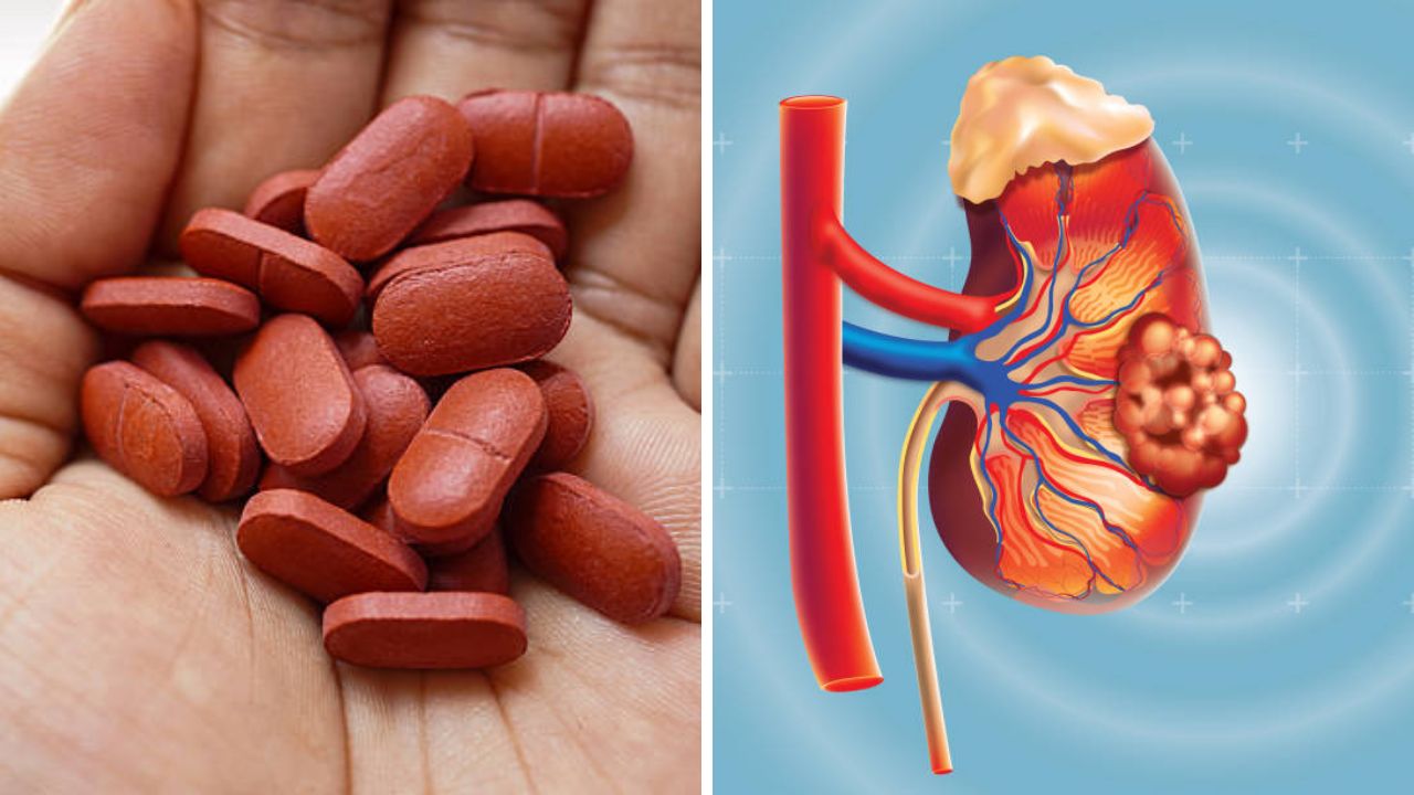वारंवार वेदनाशामक गोळ्या घेता? मग थांबा! मूत्रपिंडावर ताण येत असल्यास दिसून येतात ही गंभीर लक्षणे,
