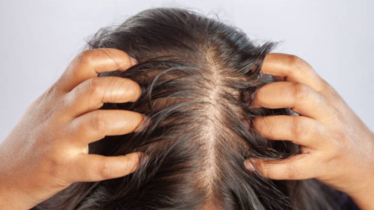Hair Care Tips: केस गळण्याआधी दिसून येतात ‘ही’ गंभीर लक्षणे, टक्कल पडू नये म्हणून जीवनशैलीत फॉलो करा निरोगी सवयी