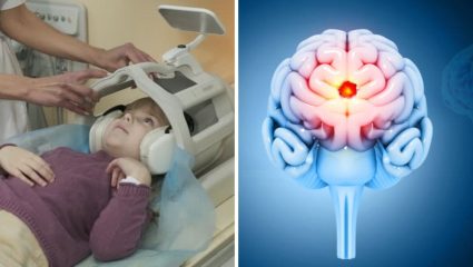 World Brain Tumor Day: मुलांमध्ये सर्वाधिक आढळणारा ब्रेन ट्यूमर कोणता? जाणून घ्या गंभीर आजारांची लक्षणे आणि त्यावरील योग्य उपचार