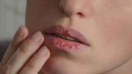 Lips Care Tips: सुकलेले काळे ओठ आठवडाभरात होतील गुलाबी!  ‘या’ टिप्स फॉलो केल्यास ओठांवरील मृत त्वचा होईल गायब