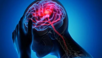 Brain Tumor : मेंदूत गाठ कशी होते अन् त्याचे धोके काय? तज्ज्ञांनी दिली सविस्तर माहिती