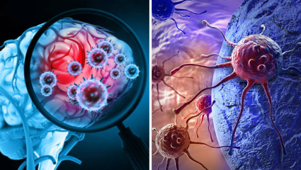 Brain Tumor: मेंदूचे आरोग्य आणि जीवनशैलीचा काय संबंध? काय आहे जोखीम