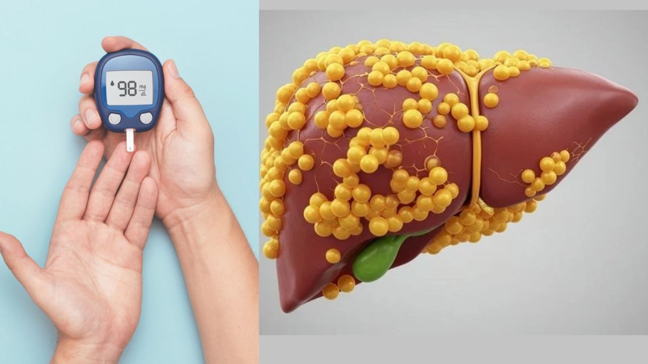 Fatty Liver: ना वजन जास्त, ना मधुमेह… तरीही फॅटी लिव्हर का होतो? जाणून घ्या खरं कारण