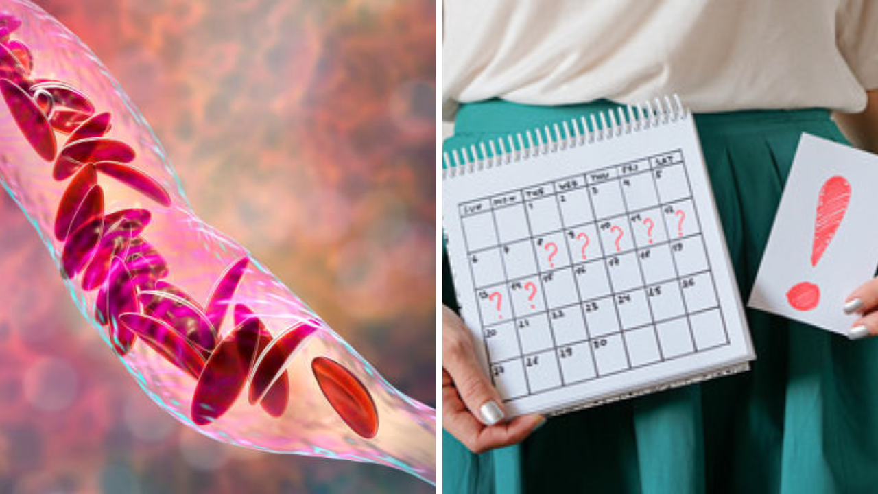 Menstrual Cycle: Sickle Cell Disease असलेल्या महिलांसाठी मासिक पाळीचा काळ अधिक आव्हानात्मक का ठरू शकतो?