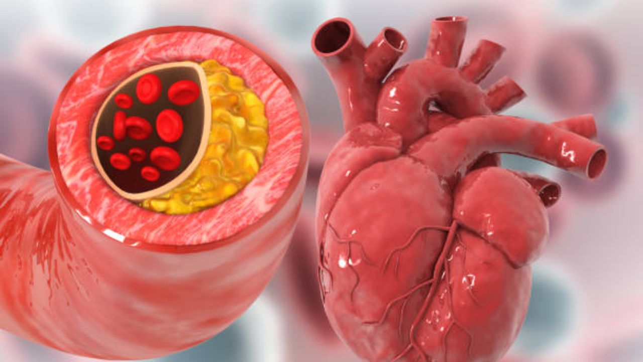 Health Update: १० पैकी ९ भारतीयांचे कोलेस्ट्रॉल खराब! आयसीएमआरच्या अहवालातून धक्कादायक निष्कर्ष समोर