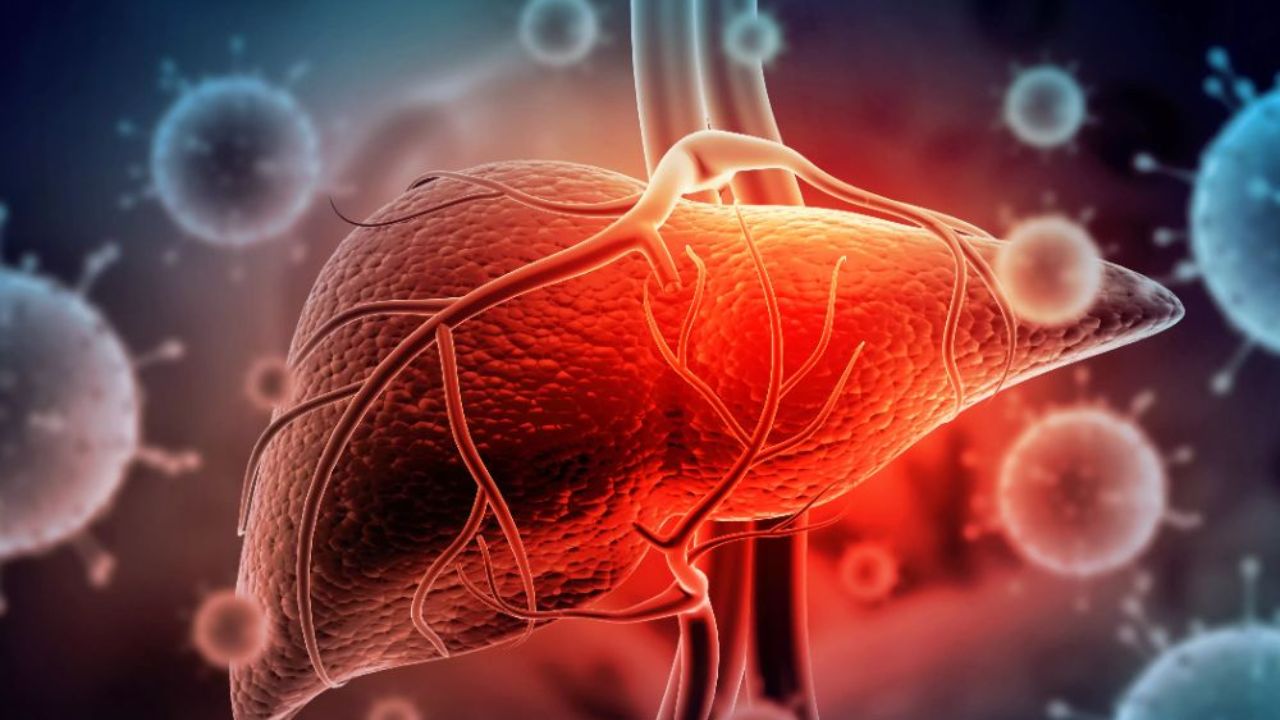 World Hepatitis Day: यकृताच्या ‘या’ सायलेंट किलर आजाराकडे करू नका दुर्लक्ष; जाणून घ्या बचाव आणि उपचारांचे उपाय