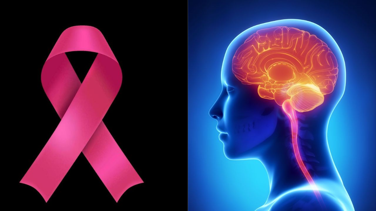 ६५ वर्षीय महिलेच्या निर्विकार नजरेमागे दडला दुर्मिळ आजार; डॉक्टरांनी कर्करोगाच्या दुर्मिळ पुनरागमनाचे केले निदान