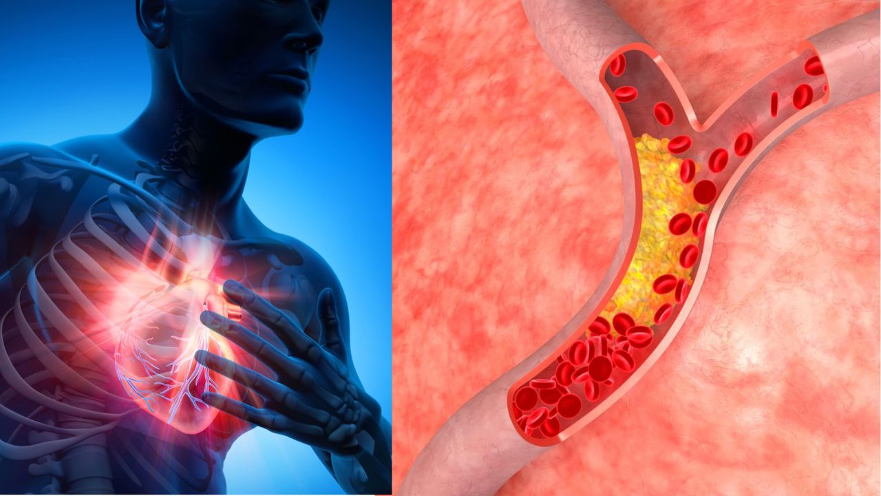 Bad Cholesterol: हेल्दी लाइफस्टाइल असूनही वाढतंय खराब कोलेस्ट्रॉल? जाणून घ्या खरी कारणं