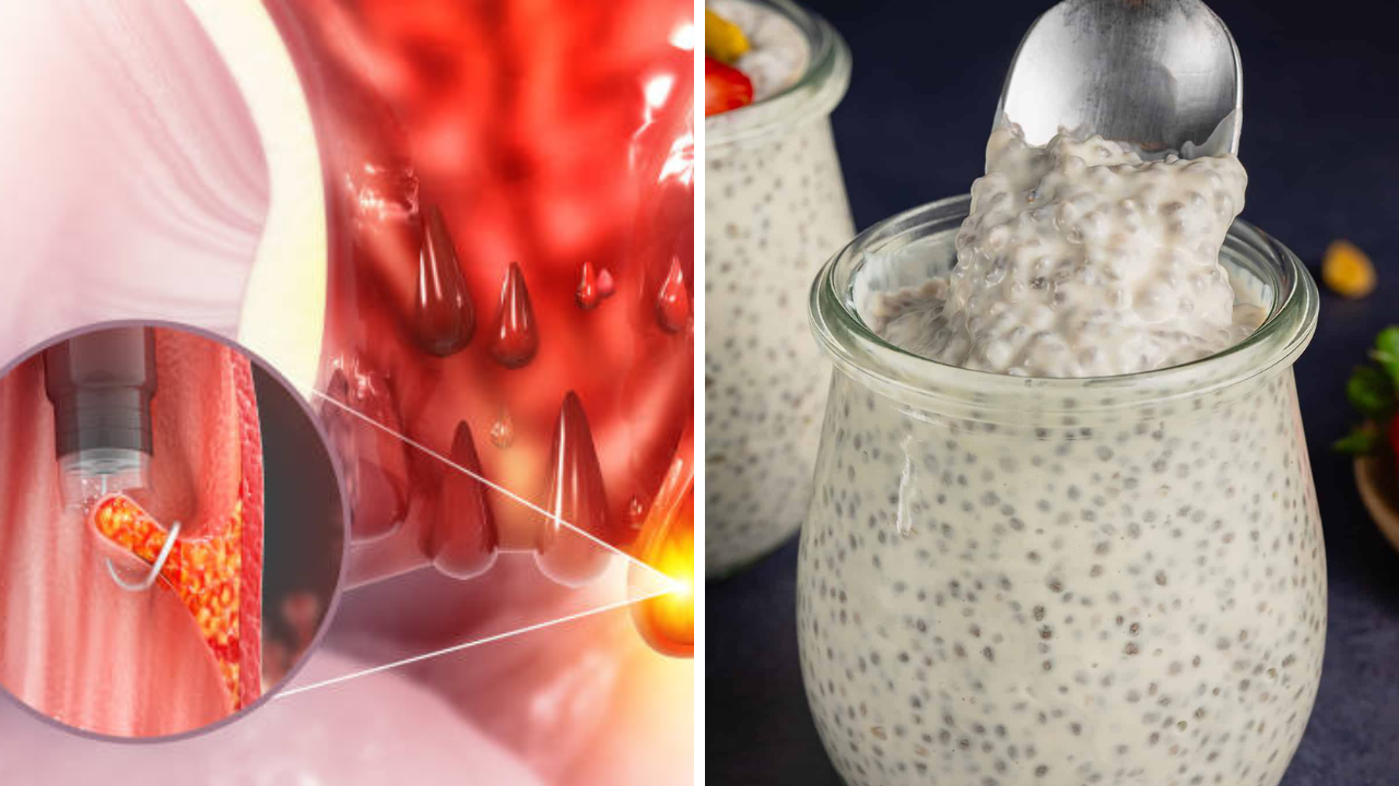 Constipation Home Remedies: बद्धकोष्ठता, ब्लोटिंग आणि आतड्यांची सूज कमी करण्यासाठी एक सोपा पदार्थ