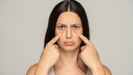 Dark Circles: ८ तास झोपूनही डोळ्यांखाली डार्क सर्कल्स? दुर्लक्ष करू नका; जाणून घ्या खरी कारणे