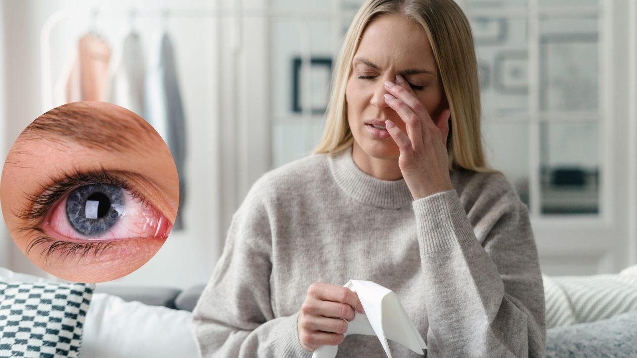 Eye Infection: पावसाळ्यात वाढतो डोळ्यांच्या इन्फेक्शनचा धोका? ‘ही’ लक्षणे दिसताच वेळीच व्हा सावध; अशी घ्या काळजी