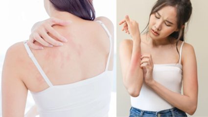 पावसात भिजल्याने वाढू शकतो त्वचेच्या संसर्गाचा धोका; स्किन इन्फेक्शन, रॅशेस अन् खाज टाळण्यासाठी करा ‘हे’ उपाय