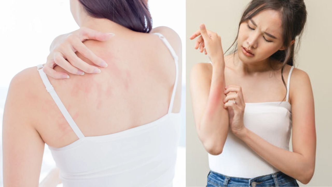 पावसात भिजल्याने वाढू शकतो त्वचेच्या संसर्गाचा धोका; स्किन इन्फेक्शन, रॅशेस अन् खाज टाळण्यासाठी करा ‘हे’ उपाय