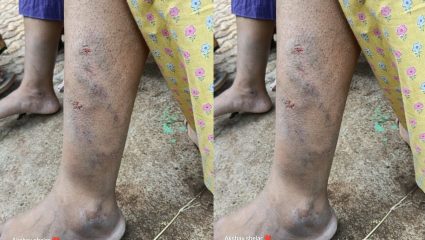 गुरुजी की गुंड? वाई तालुक्यात संतापाची लाट! मुख्याध्यापकाचा महिला शिक्षिकेवर लाकडी दांडक्याने अमानुष हल्ला