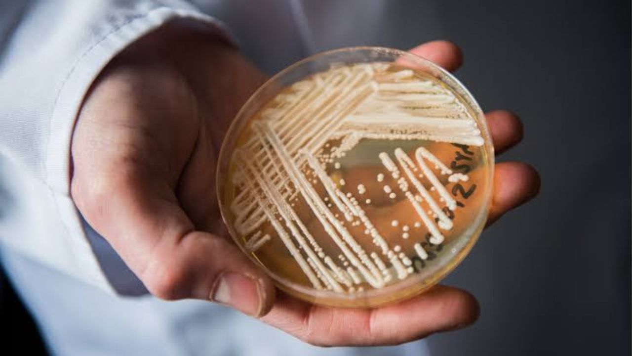 Candida Auris: अमेरिकेत ‘कॅन्डिडा ऑरिस’ प्राणघातक बुरशीचा उद्रेक; औषधांनाही दाद न देणाऱ्या ‘सुपरबग’मुळे आरोग्य यंत्रणा हाय अलर्टवर