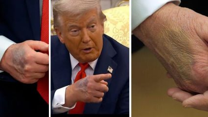 Donald Trump: व्हाईट हाऊसने ट्रम्प यांच्या प्रकृतीबाबत खोटे सांगितले? हृदयरोगतज्ज्ञ डॉ. जोनाथन रायनर यांचा मोठा दावा