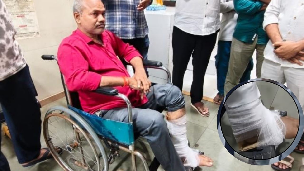 Rukminibai Hospital: फ्रॅक्चर झालेल्या वृद्धाच्या पायाला प्लास्टरऐवजी पुठ्ठा, रुक्मिणीबाई रुग्णालयाचा आणखी एक धक्कादायक प्रकार