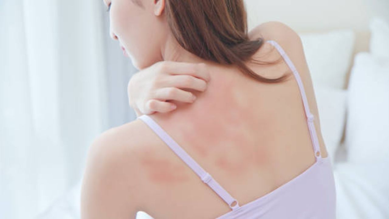 पावसाळ्यात का वाढतो Fungal Infections चा धोका? त्वचेसंबंधित दिसून येणाऱ्या ‘या’ लक्षणांकडे अजिबात करू नका दुर्लक्ष