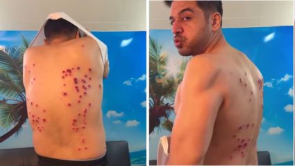 Gaurav Khanna Viral Photos: रबर बुलेट लागून गौरव खन्ना जखमी; ‘खतरों के खिलाडी 15’मधील स्टंटवर नेटकऱ्यांचा संताप