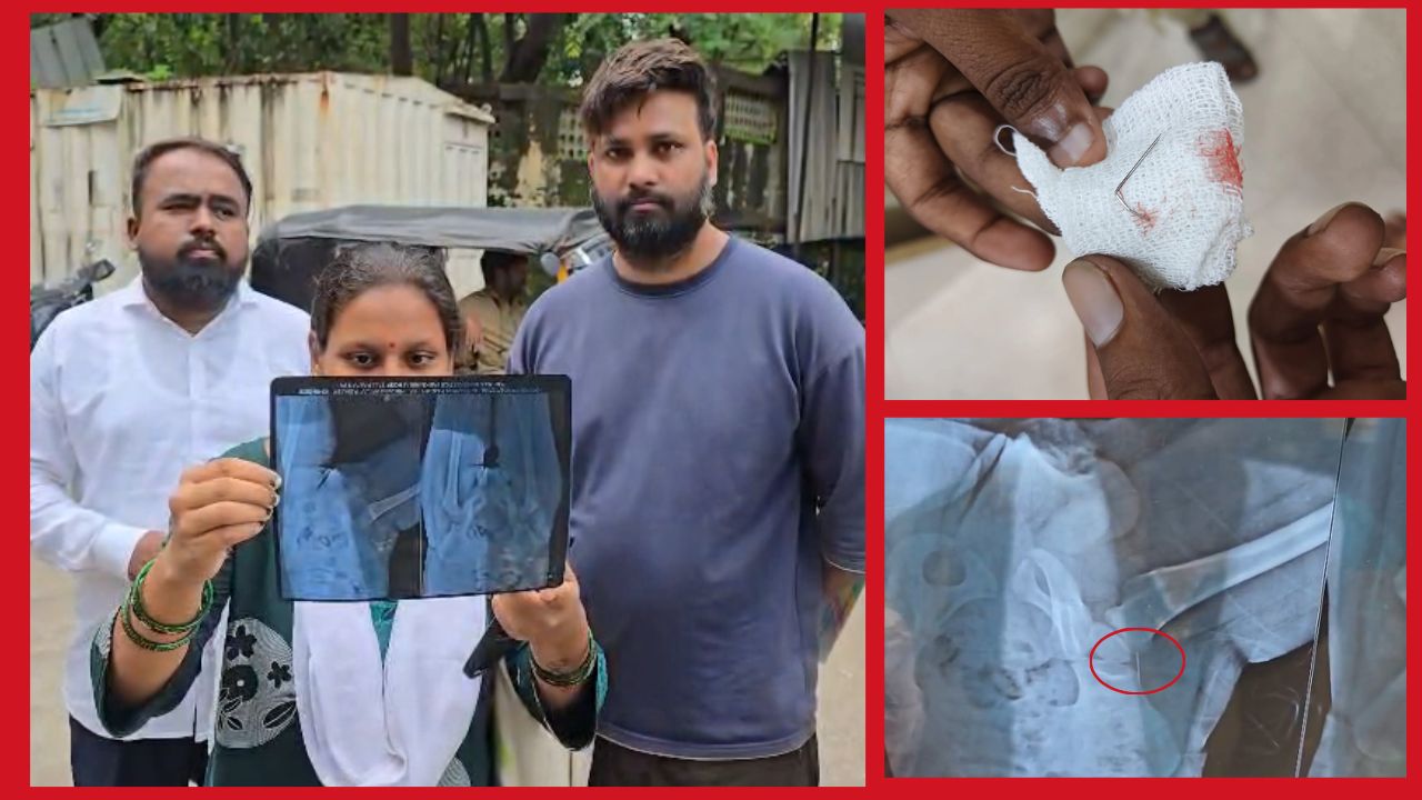 KDMC Hospital News: रुक्मिणीबाई रुग्णालयात धक्कादायक निष्काळजीपणा; लहान मुलाच्या कमरेत अडकली इंजेक्शनची सुई