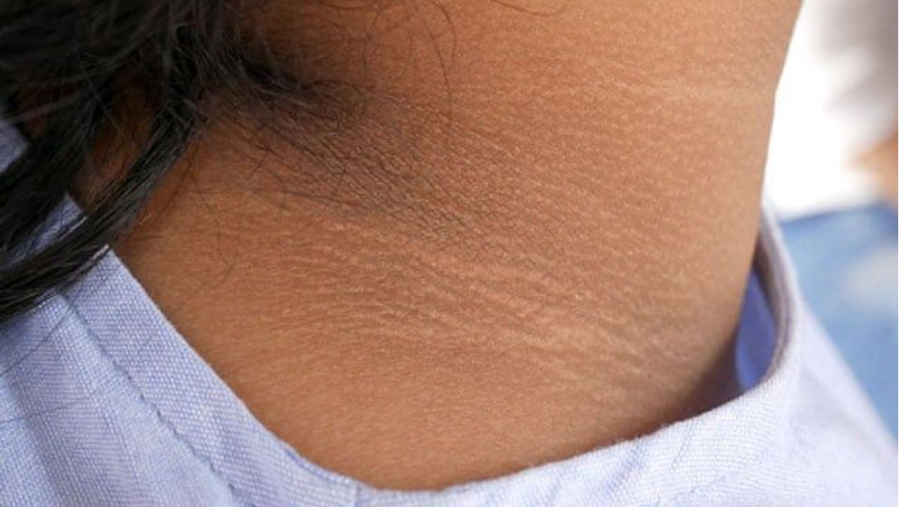मान आणि पाठीवर साचलेला मळ दूर करायचाय? मग घरीच अशाप्रक्रारे तयार करा बेसन-दह्याचा नैसर्गिक क्लींजर