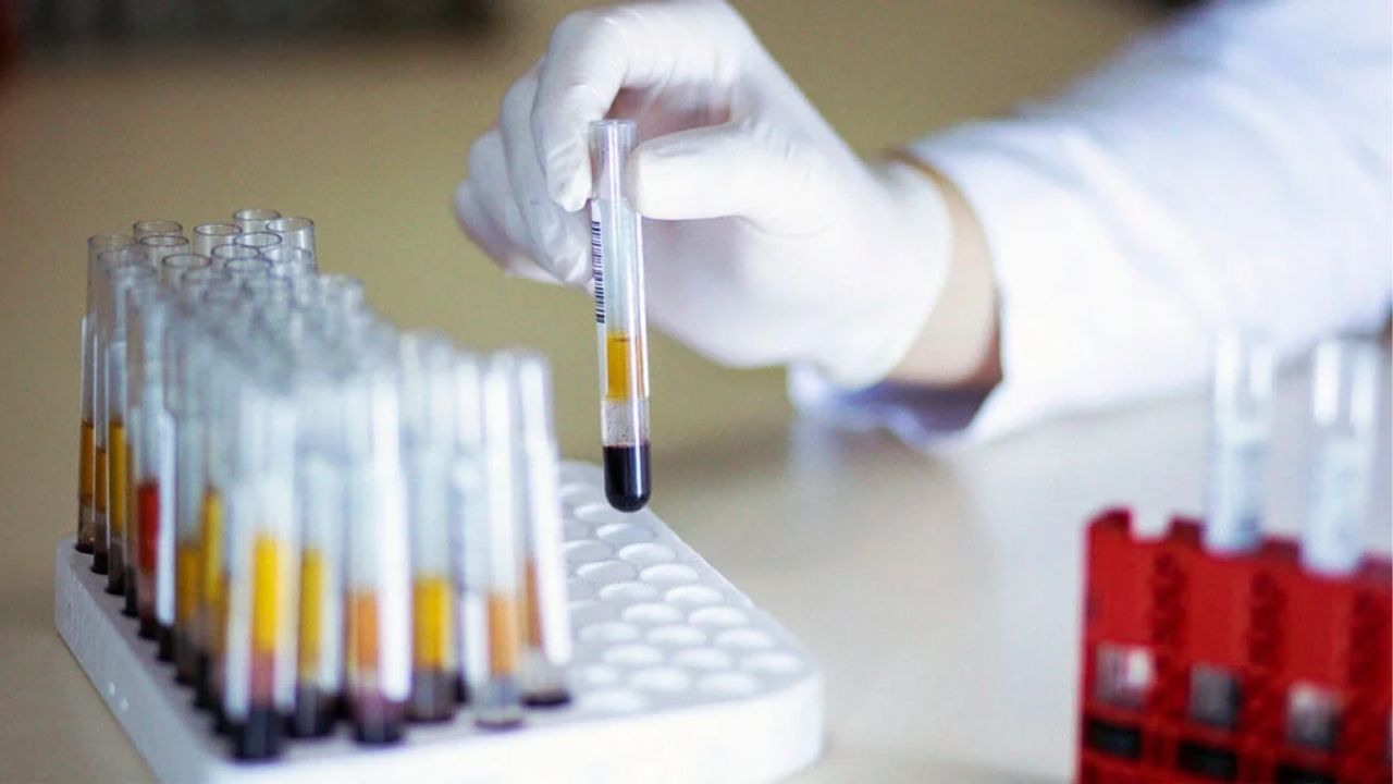APL Blood Cancer: ताप गेला पण रक्तात गडबड कायम, तपासणी केली तर निघाला दुर्मिळ रक्ताचा कॅन्सर