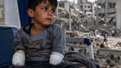 Gaza Horror : गाझातील चिमुकल्यांचे हात-पाय गेले; युद्धाच्या जखमा आयुष्यभराच्या