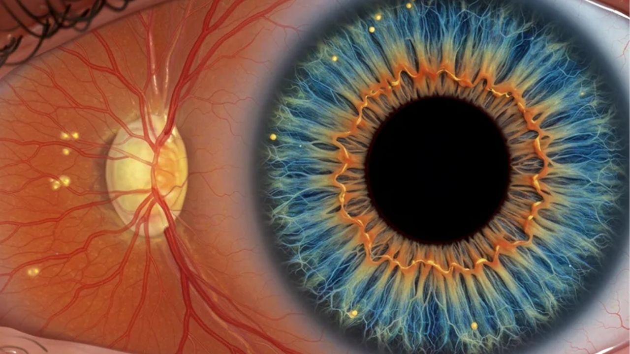 Diabetic Retinopathy: दिसतंय म्हणून डोळे निरोगी आहेत असं समजू नका! रेटिनाच्या आजाराचा धोका ओळखा