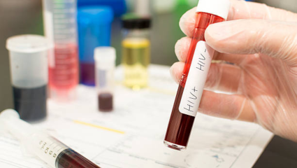 HIV: काय आहे अँटीरिट्रोव्हायरल थेरपी? HIV सह अधिक काळ जगताना वेगळ्या दृष्टिकोनातून पाहण्याची गरज