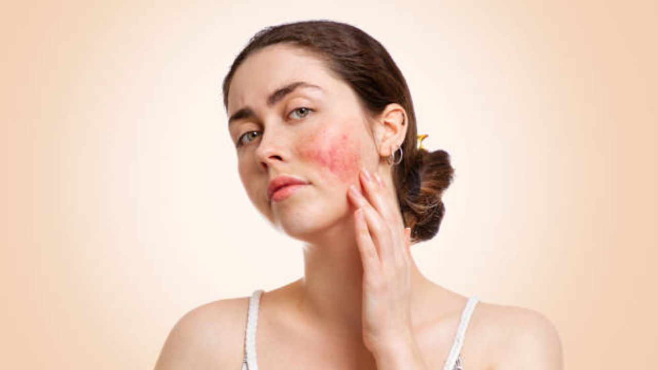 Skin Care Tips: स्वयंपाक बनवताना तासनतास शेगडीजवळ राहील चेहरा काळा पडला आहे? पिग्मेंटेशन घालवण्यासाठी करा ‘हे’ उपाय