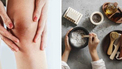 Home Remedies: कोपर आणि गुडघे कायमच काळेकुट दिसतात? मग स्वयंपाक घरात उपलब्ध असलेल्या ‘या’ पदार्थांपासून बनवा नॅचरल स्क्रब