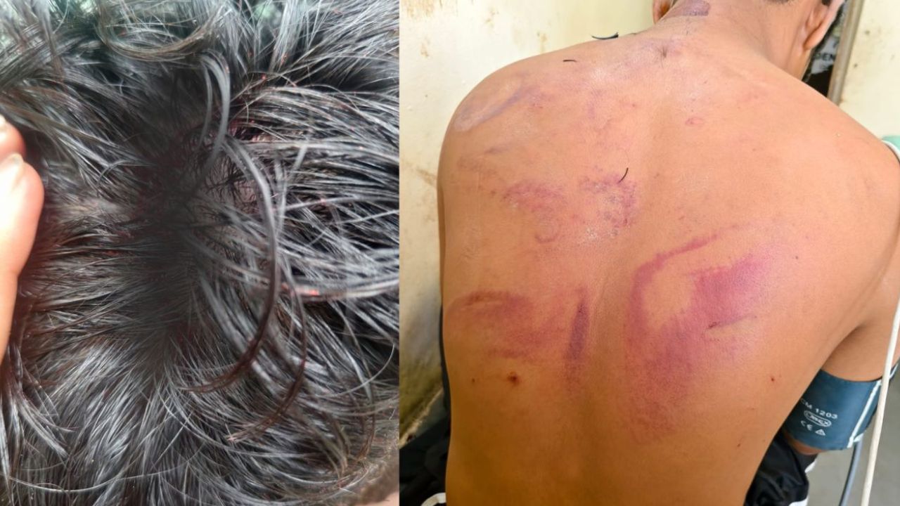 Crime News: शेटफळमध्ये एका वादातून गाव पेटलं; जवानावर सत्तूरने वार, 100 जणांचा जमाव रस्त्यावर