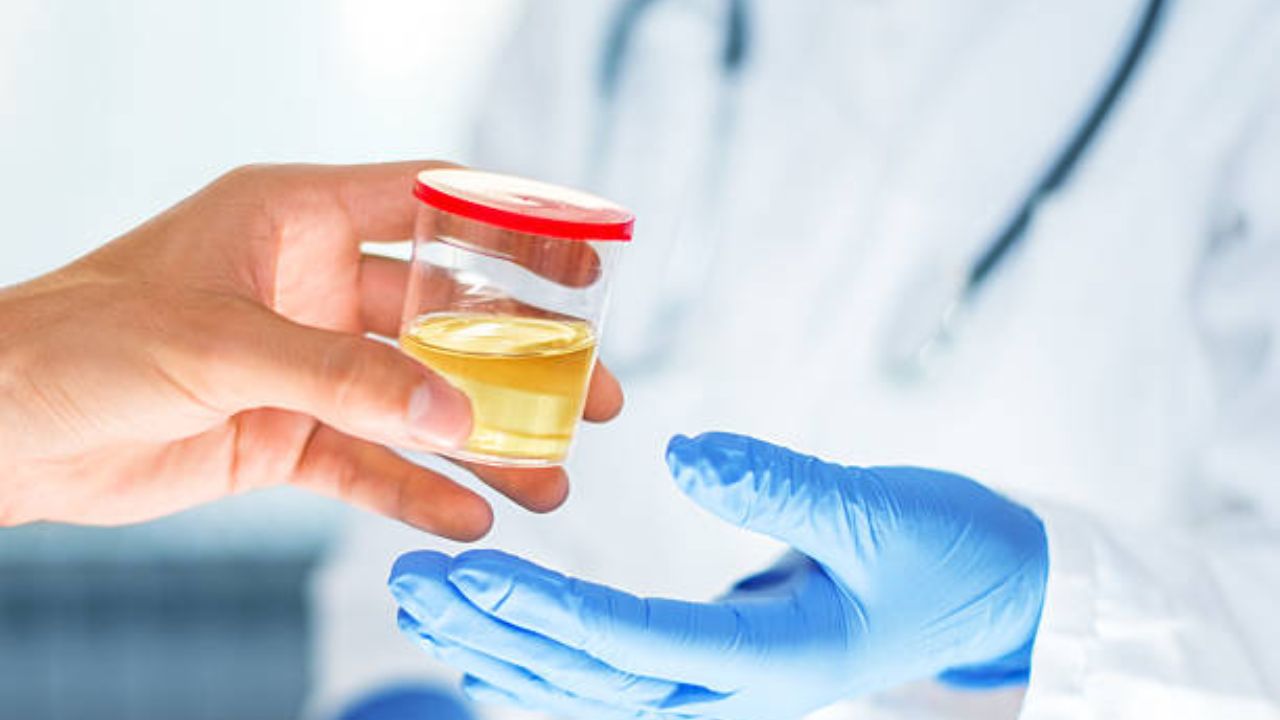 Kidney Health: लघवीच्या रंगात दिसलेल्या ‘या’ बदलांकडे अजिबात करू नका दुर्लक्ष! इनफेक्शन वाढल्यास किडनी- लिव्हर होईल कायमचे निकामी