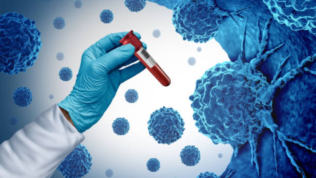 Cancer: कर्करोगाचा धोका वेळीच ओळखायचा? नियमित आरोग्य तपासणीतील ‘या’ चाचण्या ठरू शकतात अतिशय महत्त्वाच्या