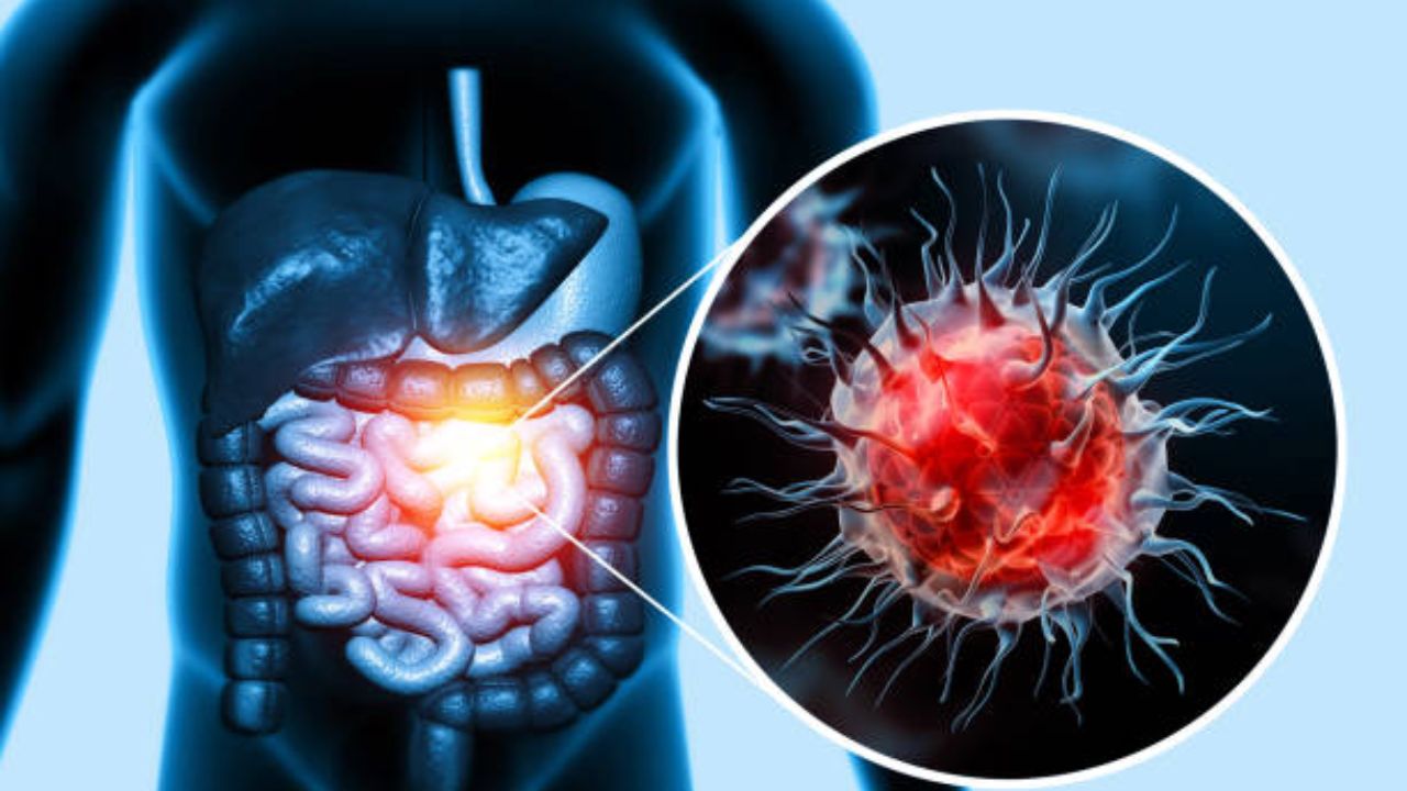 Colorectal Cancer: आतड्यांच्या कॅन्सरपासून कायमच राहाल लांब! रोजच्या आहारात करा ‘या’ भाज्या आणि फळांचा समावेश, शरीर राहील स्वच्छ