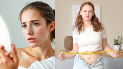Health Tips: चेहऱ्यावर पिंपल्स, वाढत वजन अन्…; ‘या’ लक्षणांकडे दुर्लक्ष करू नका, अन्यथा…