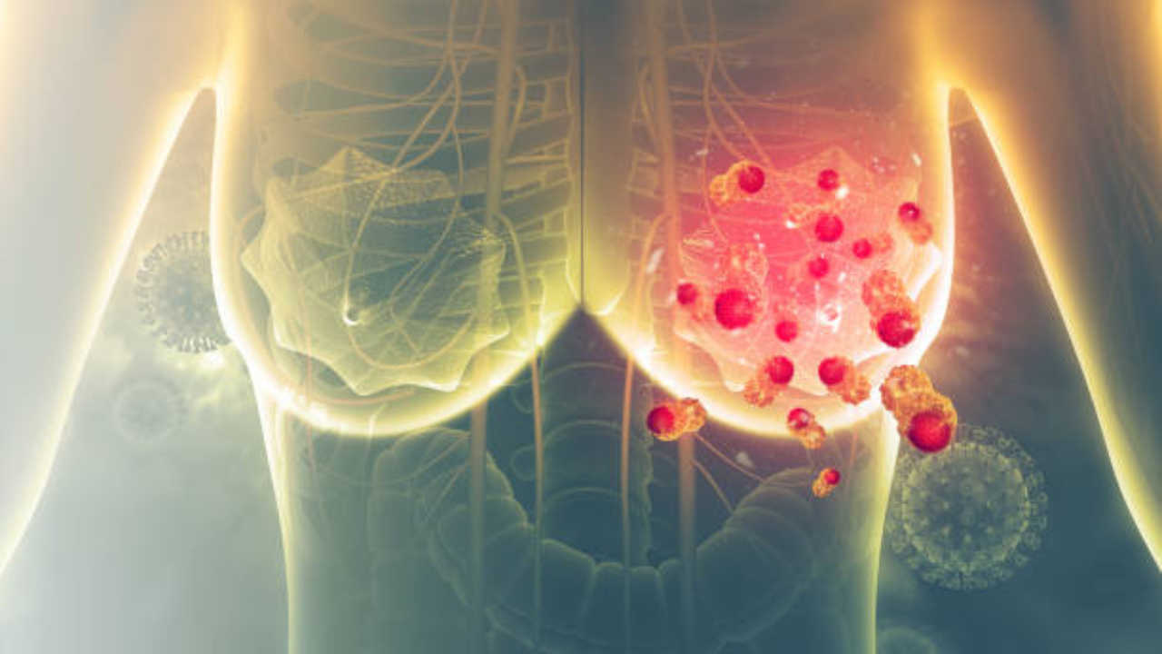 Health News: ‘वय वर्ष 35, अजूनही मूल नाही Breast Cancer होईल’, खरंच या दाव्यात किती तथ्य, तज्ज्ञांनी केला खुलासा