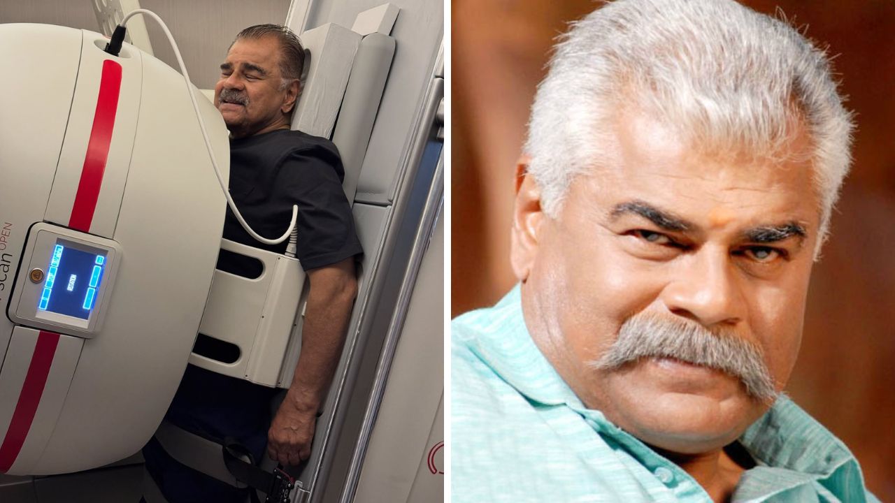 Sharat Saxena: उभं राहून MRI करणाऱ्या शरत सक्सेनांचे फोटो चर्चेत; सर्जरीपूर्वी चाहत्यांनी व्यक्त केली चिंता