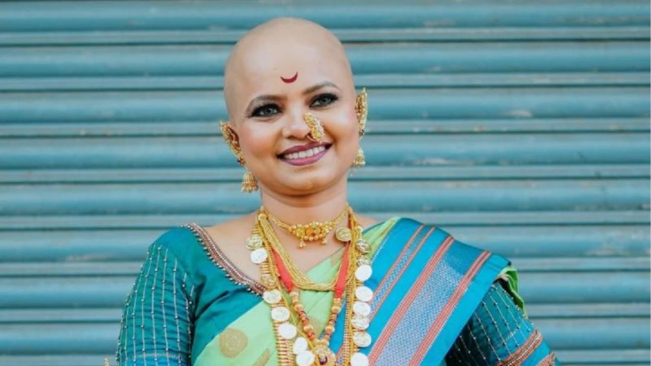 आता कोणाची भीती तिला वाटत नाही. अनेक मुलींसाठी प्रेरणा बनलीसोनाली फक्त स्वतःसाठी जगली नाही. तिच्यासारख्या ज्या दुसऱ्या मुली आहेत, ज्यांना केसांची समस्या आहे, त्यांना ती मदत करते. त्यांच्याशी बोलते, त्यांना धीर देते.