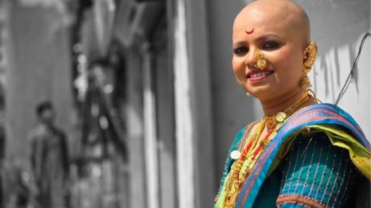 अनेक मुली तिला मेसेज करतात की ताई, आम्हाला पण हाच प्रॉब्लेम आहे, आम्हाला बाहेर जायची लाज वाटते. तेव्हा सोनाली त्यांना समजावते की सुंदरता केसात नसते. सुंदरता आपल्या मनात असते, आपल्या कामात असते. तिचे हे बोलणे ऐकून कित्येक मुलींना नवी हिंमत मिळाली आहे.