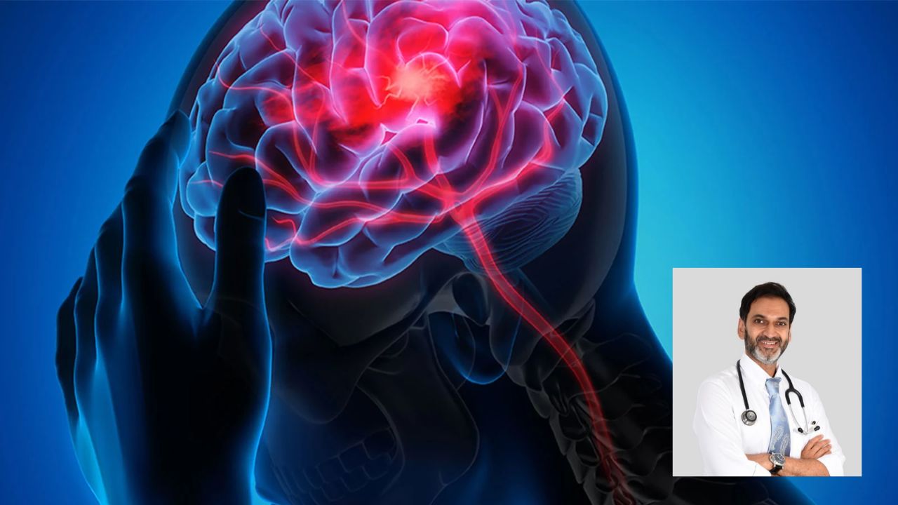 World Stroke Day : फक्त BP नाही, तर ‘या’ संसर्गांमुळेही वाढू शकतो ब्रेन अटॅकचा धोका; वयाच्या ५० नंतर कशी घ्यावी काळजी?
