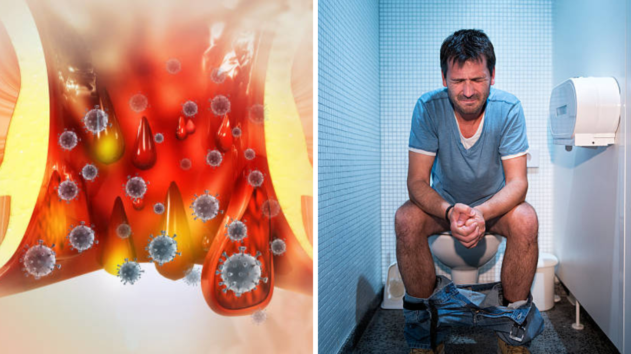Constipation Problem: बद्धकोष्ठतेने पोट फुगतं पण दुखत नाही? डॉक्टरांना नक्की कधी भेटावं